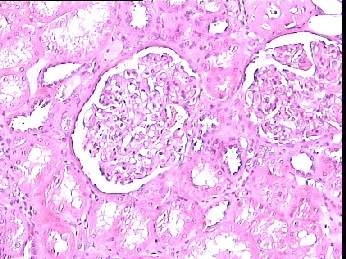 Glomerulus Tissue