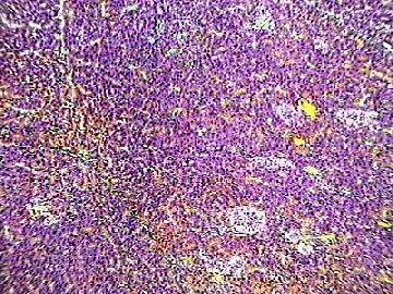 Pancreatic islet cells