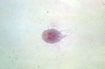 Giardia lamblia