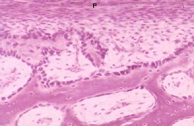 Osteoblastic activity