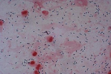 Streptococcus pneumoniae