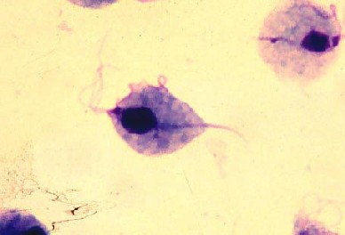 Trichomonas vaginalis
